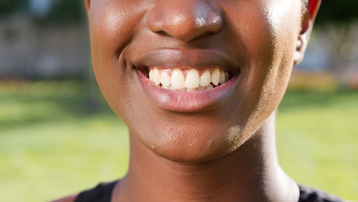 Cosmetic Dentistry at De Santi Dental